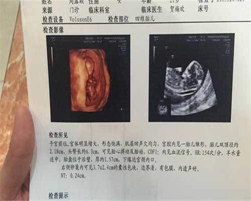 不孕不育检查医院