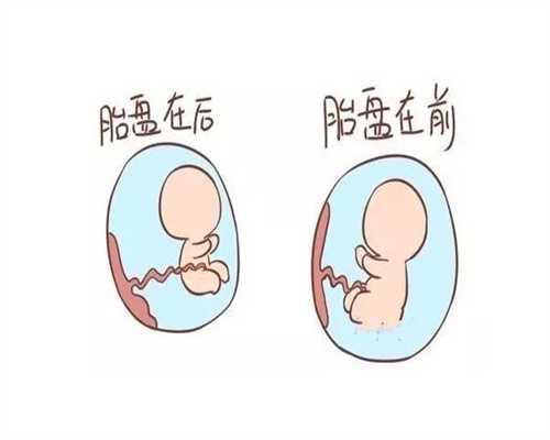 死精症不育